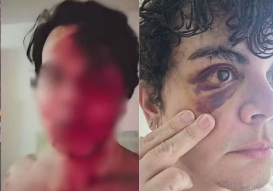 Rosto do médico com hematomas 