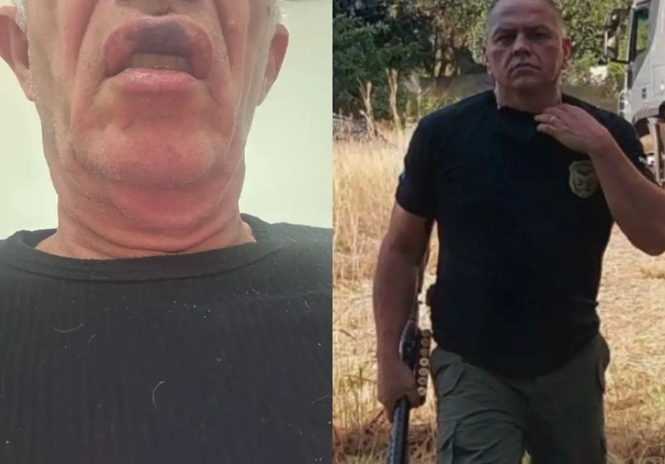 Idoso após agressão em condomínio