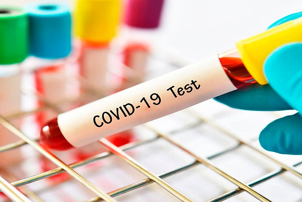 Teste sorológico Elecsys®️ Anti-SARS-CoV-2 Teste sorológico Elecsys®️ Anti-SARS-CoV-2